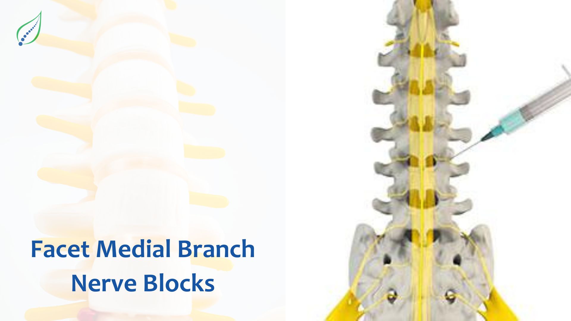 Facet Medial Branch Nerve Blocks